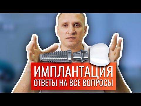 Видео: Зубные импланты - О самом главном. Имплантация зубов. Стоматология Ставрополь. Доктор Коннов.