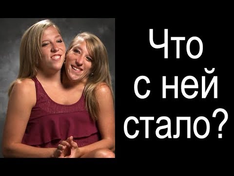 Видео: А У НАС БЫ ЕЁ СРАЗУ ЗАЛОШИЛИ. двухголовая девушка