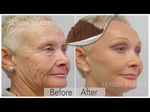 Видео: Антивозрастная маска! За 3 дня подтягивает кожу и заполняет морщины и тонкие линии.