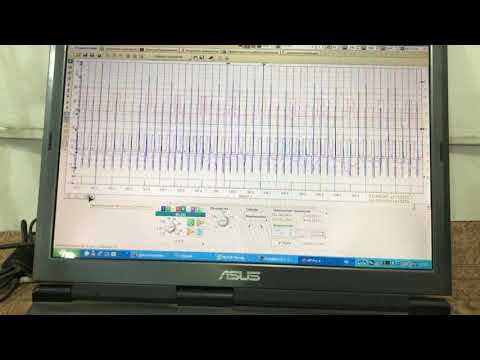 Видео: Mazda 626 глохнет когда прогрета.