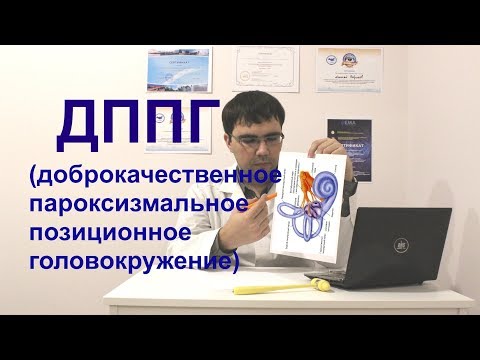 Видео: Доброкачественное позиционное пароксизмальное головокружение (ДППГ/BPPV)