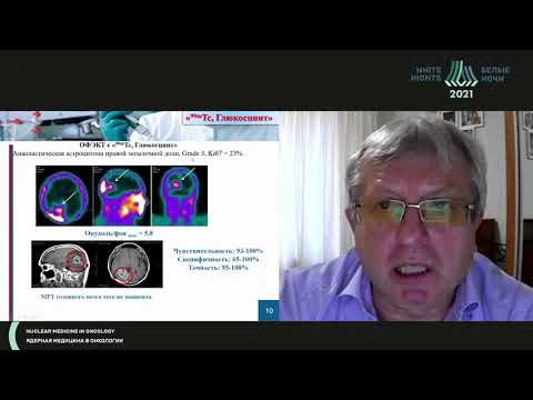 Видео: ОФЭКТ опухолей головного мозга