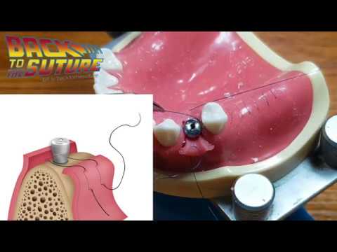 Видео: [Back2thesuture] Лоскутный шов для максимального кератинизирования ткани вокруг имплантата!