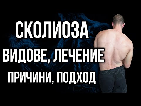 Видео: Какво е СКОЛИОЗА - Видове, Причини, Упражнения, Тестове