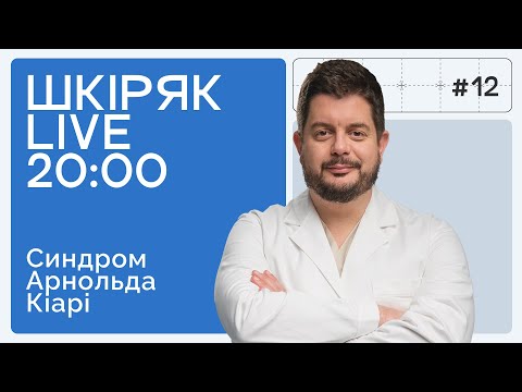 Видео: Синдром, який часто плутають з мігренню! | ШКІРЯК LIVE.