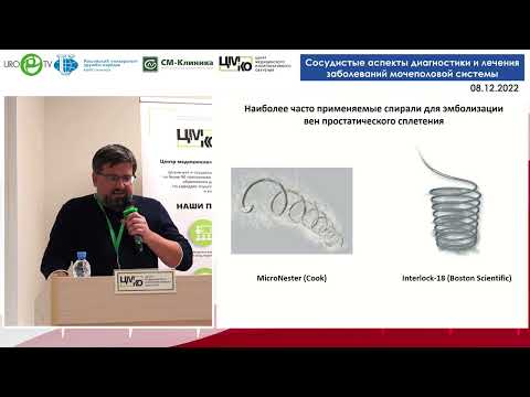 Видео: Панков А.С. Окклюзия простатического сплетения в лечении веногенной эректильной дисфункции.