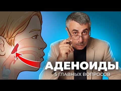 Видео: 5 главных вопросов про аденоиды