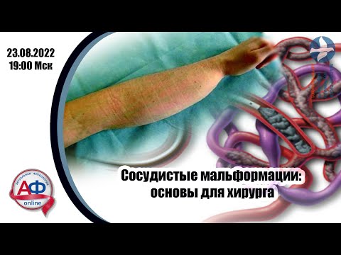 Видео: Сосудистые мальформации: основы для хирурга