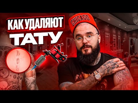 Видео: ВОПРОС/ОТВЕТ ПРО УДАЛЕНИЕ ТАТУ 2025
