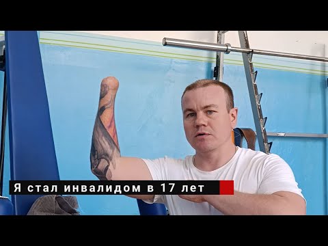 Видео: История одного инвалида с ампутацией рук | МОТИВАЦИЯ | #АпМутант