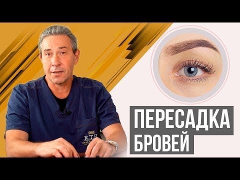 Видео: Пересадка бровей. Собственные густые брови навсегда. До и после.