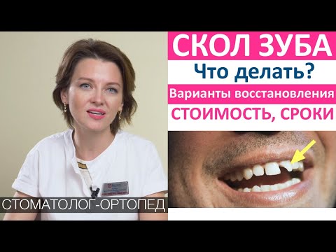 Видео: Скол зуба - что делать, сколько стоит восстановить зуб и как быстро восстанавливается сломанный зуб