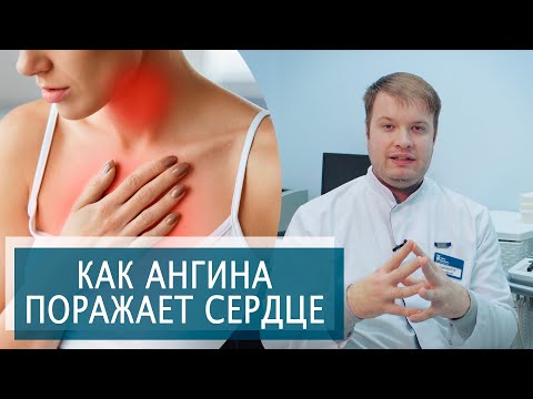 Видео: КАК АНГИНА , ТОНЗИЛЛИТ ПОРАЖАЕТ СЕРДЦЕ? | Ревматическая болезнь сердца | Симптомы, Лечение