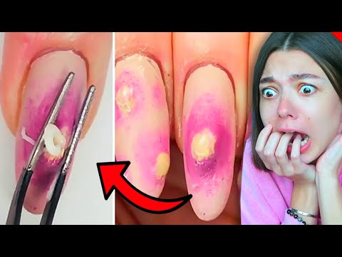 Видео: УЖАСНЫЙ МАНИКЮР С ПРЫЩАМИ! ТОП 10 необычный дизайн ногтей!