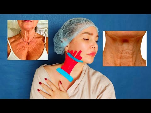 Видео: Эффективное ТЕЙПИРОВАНИЕ ШЕИ | Омоложение шеи при помощи тейпов