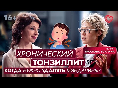 Видео: Хронический тонзиллит: когда нужно УДАЛЯТЬ МИНДАЛИНЫ?