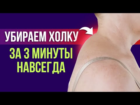 Видео: Сделай это упражнение 1 раз и ХОЛКА ИСЧЕЗНЕТ!