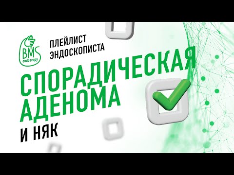 Видео: 🟢Эндоскопическое удаление спорадической аденомы при язвенном колите #playlistэндоскописта