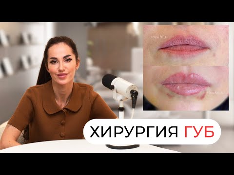 Видео: Как НАВСЕГДА увеличить губы без филлеров? Новый тренд: хейлопластика