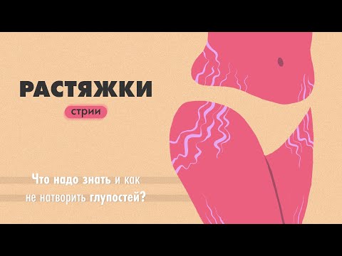 Видео: Растяжки (стрии). Что надо знать и как не натворить глупостей?