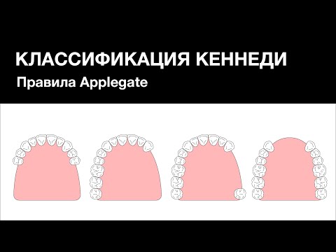 Видео: Классификация Кеннеди. Правила Applegate.