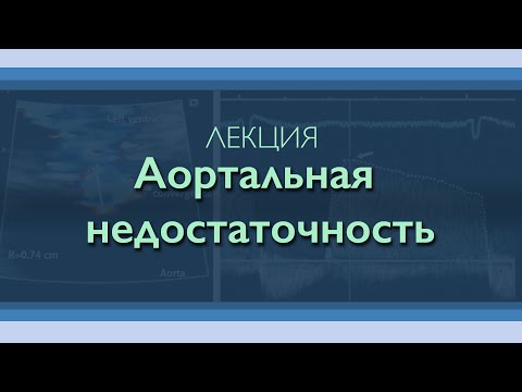 Видео: Аортальная недостаточность