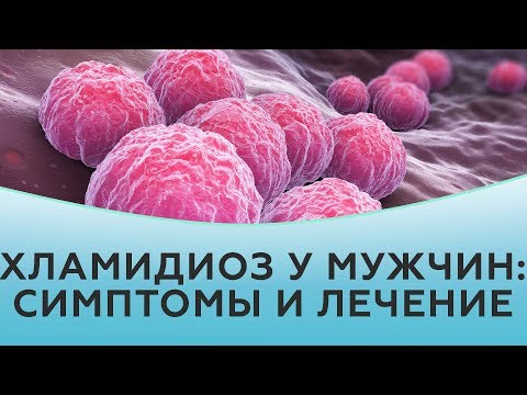 Видео: Хламидиоз у мужчин. Хламидиоз симптомы. Хламидиоз лечение