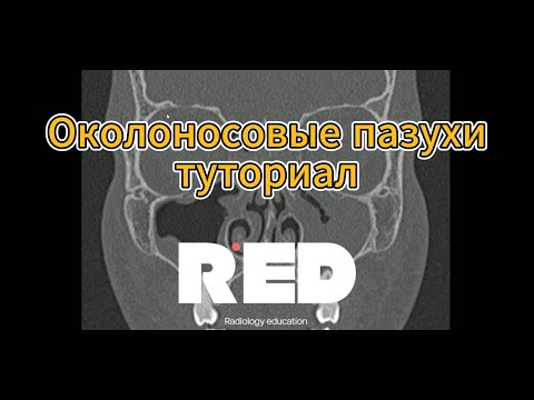 Видео: Околоносовые пазухи на КТ. Туториал для начинающих