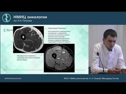 Видео: Сложные вопросы лучевой диагностики сарком мягких тканей