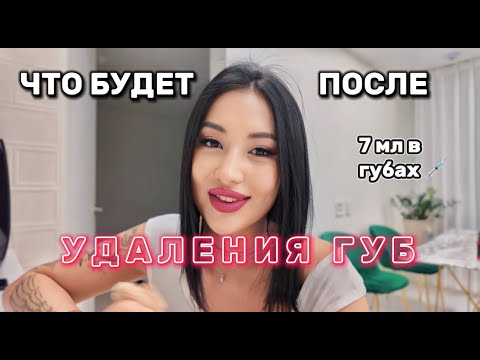Видео: УВЕЛИЧЕНИЕ ГУБ И ПОДБОРОДКА | Мой опыт | Удаление губ | Последствия| 7 мл 😰