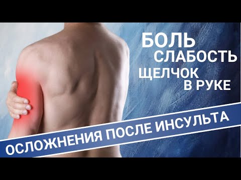 Видео: БОЛЬ, СЛАБОСТЬ, ЩЕЛЧОК ПРИ ДВИЖЕНИИ В РУКЕ ПОСЛЕ ИНСУЛЬТА. Ответы на ваши вопросы