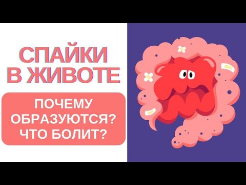 Видео: 🔥 Спайки в животе. Почему образуются? Средство!