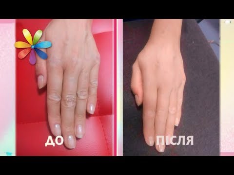 Видео: Супер увлажняющая ванна из желе – Все буде добре. Выпуск 1140 от 14.12.17