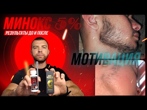 Видео: НЕ плачь если борода не выросла за 3 месяца. Мотивация на курсе Минокса. Выпуск 14