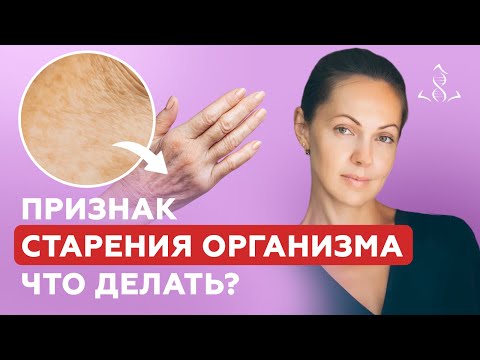 Видео: Опасный симптом или косметический дефект? | Возрастная пигментация