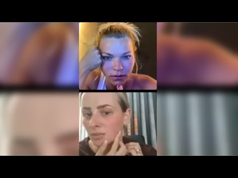 Видео: Подбор индивидуального домашнего ухода бесплатно в прямом эфире. Пациент 15 лет мазался Синофланом