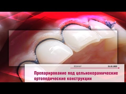 Видео: Вебинар «Препарирование под цельнокерамические ортопедические конструкции»