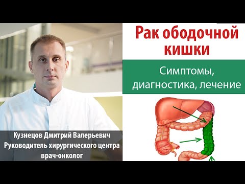 Видео: Рак ободочной кишки. Симптомы, диагностика, лечение