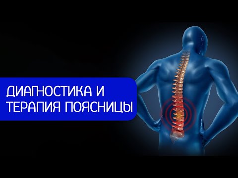 Видео: Боли в спине? Не смотрите результаты МРТ. Пример терапии поясничного отдела
