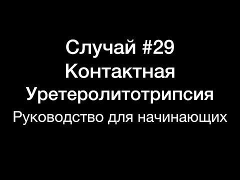 Видео: Контактная уретеролитотрипсия. Руководство для начинающих. Случай #29