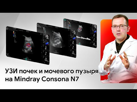 Видео: УЗИ почек и мочевого пузыря на Mindray Consona N7. Практический мастер-класс