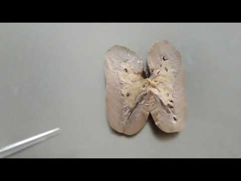 Видео: Видеозанятие 28 «Органы мочеотделения»