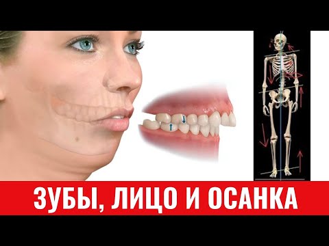 Видео: Зубы и их влияние на лицо и осанку. ТРАНСЛЯЦИЯ.