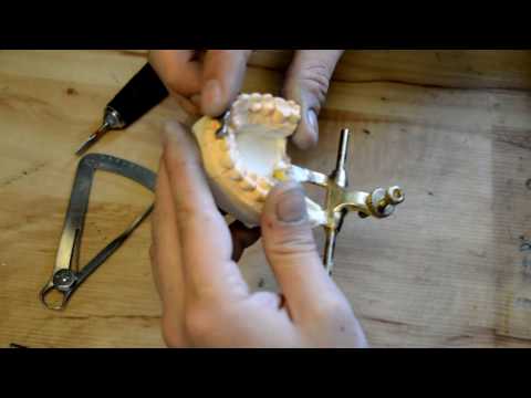 Видео: металлокерамика часть 1  ( каркасы)