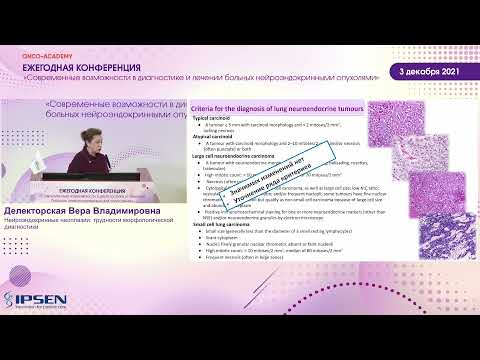 Видео: Нейроэндокринные неоплазии: трудности морфологической диагностики.