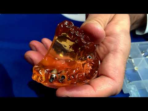 Видео: Мастер Класс и Презентация Компонентов Имплантационной Системы Anthogyr