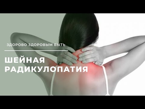 Видео: Шейная радикулопатия