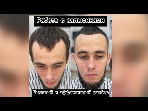Видео: Мужская стрижка | Работа с залысинами | Краткий обзор |