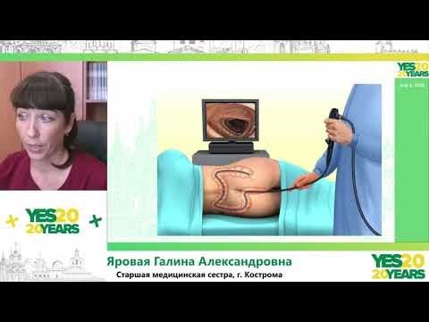 Видео: 93. Ручное пособие медицинской сестры при проведении колоноскопии. Г. А. Яровая