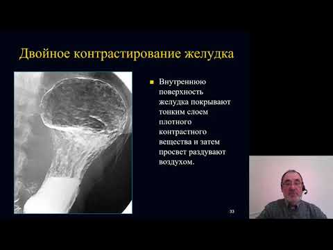Видео: Лучевая диагностика 5. Лучевая диагностика желудочно кишечного тракта